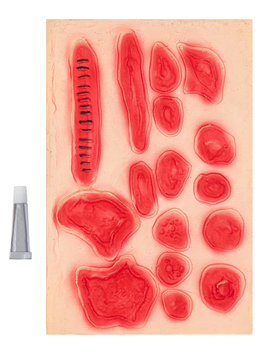 Infected Wound Set Teminis.lt