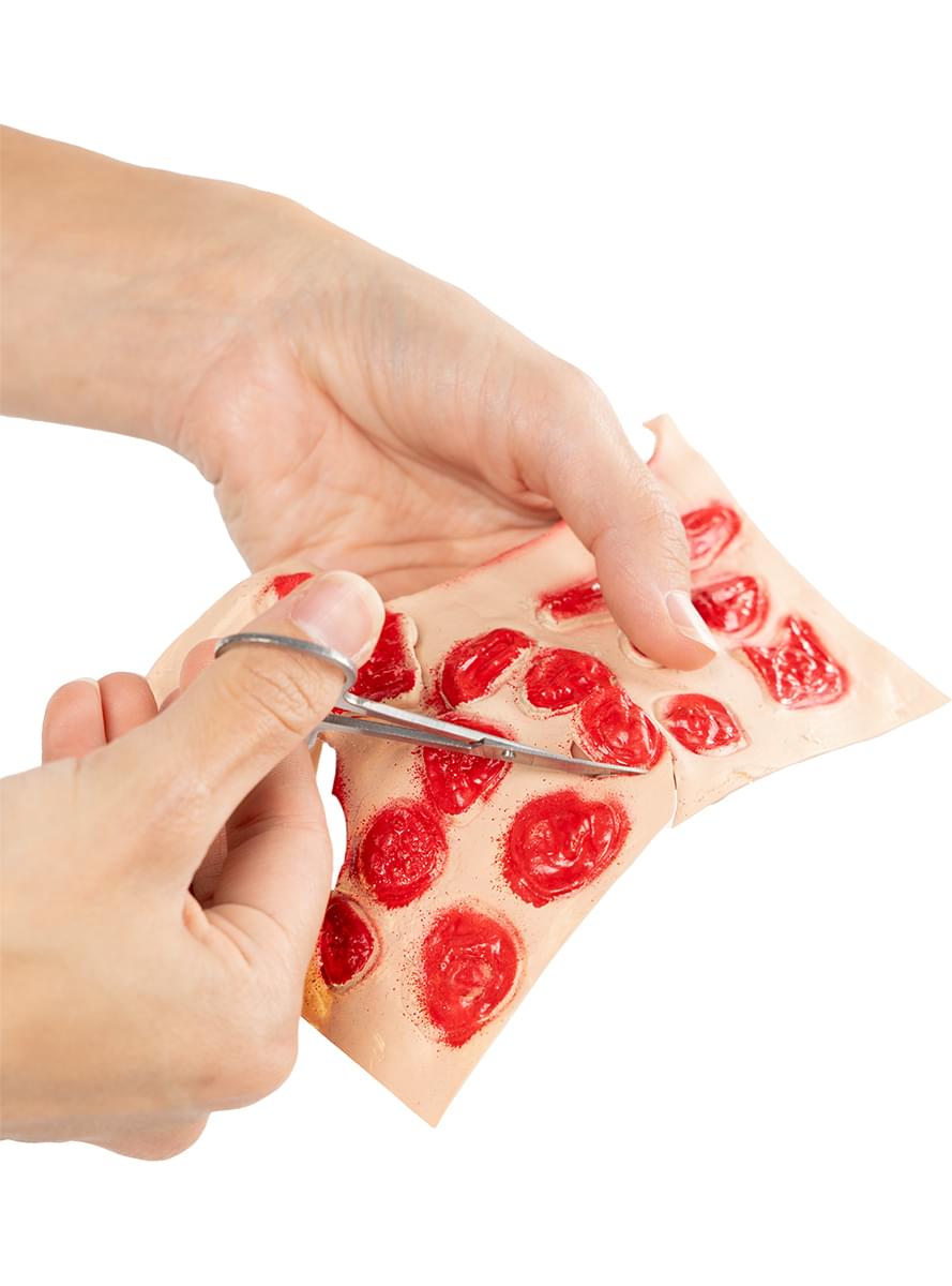 Infected Wound Set Teminis.lt